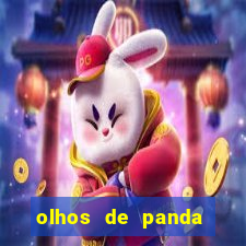 olhos de panda trauma olhos de panda significado